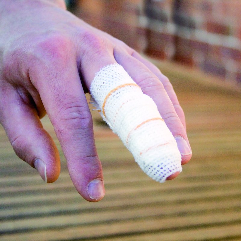 310_Finger_modelB