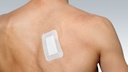 6806_SteroporeWoundDressingOn